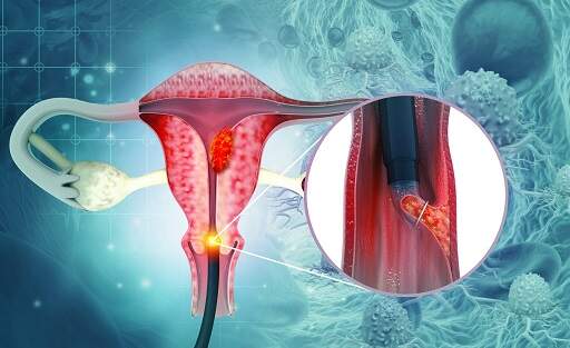 1701879863490453.jpg Dec-22_cancer_cover--scaled.jpg