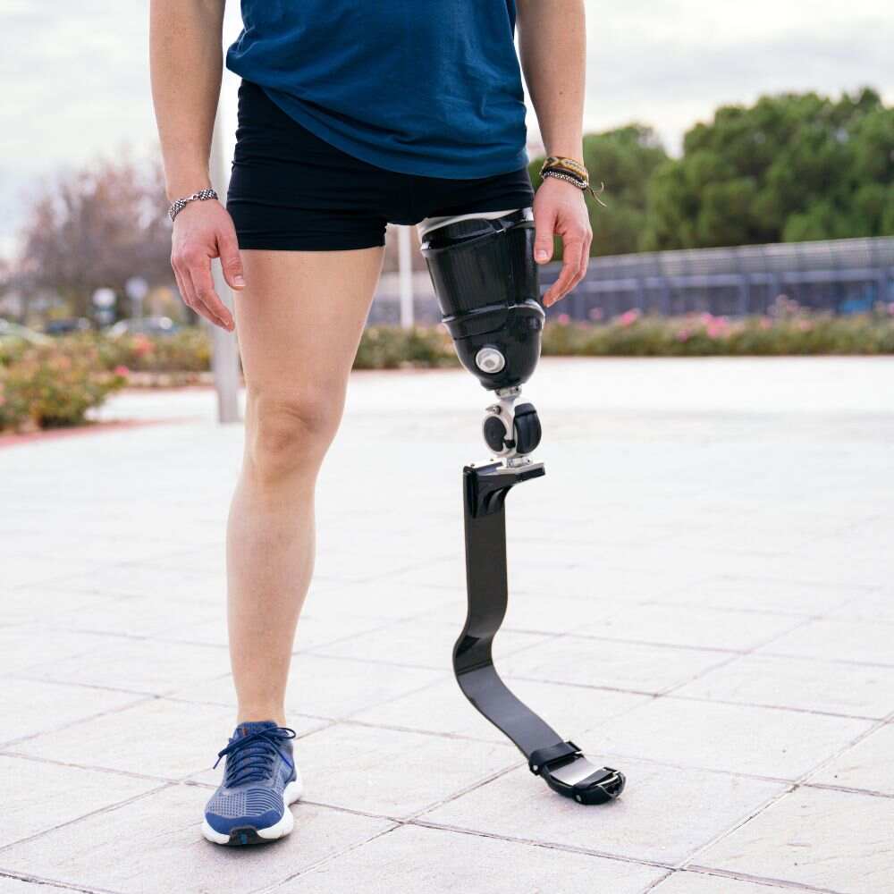 Top 5 prosthetic manufacturers redefining mobility with innovative technology