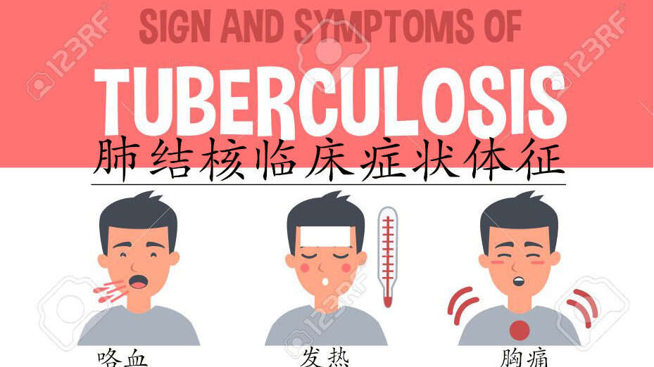 出国看病  肺结核的临床表现