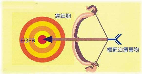 出国看病  晚期或转移性非小细胞肺癌的靶向治疗